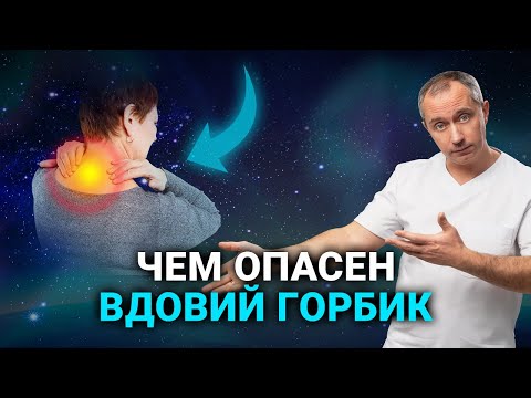 Видео: Важная информация! Вдовий горбик (холка). Влияние на здоровье женщин