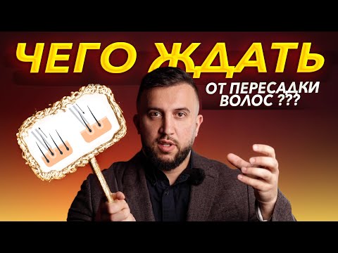 Видео: ЧЕГО ЖДАТЬ ОТ ПЕРЕСАДКИ ВОЛОС?