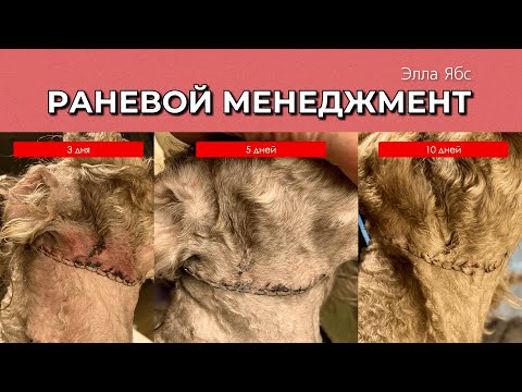 Видео: Раневой менеджмент