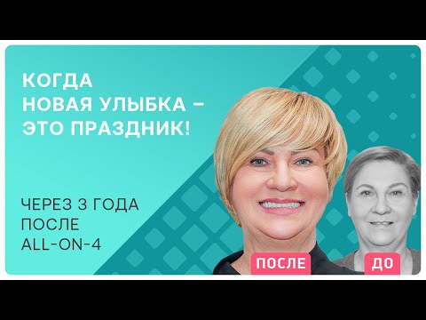 Видео: All-on-4: какие ощущения от несъемных протезов на имплантах? Рассказываю!