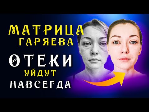 Видео: Матрица Гаряева для Очищения Лимфы ☀️ Восстановление Лимфатической Системы ☀️Исцеление Звуком