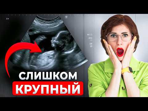 Видео: Как контролировать развитие плода? Не дай ему набрать слишком большой вес!