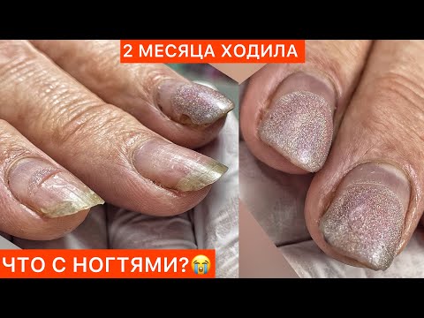 Видео: СРОЧНО🚨 ОТСЛОЙКИ С ТОРЦА🤬ДЕЛАЙ ТАК И ПРОБЛЕМЫ УЙДУТ