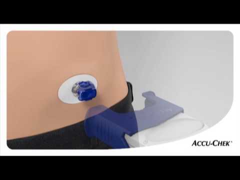 Видео: Установка инфузионного набора Акку-Чек ФлексЛинк с помощью устройства Акку-Чек Линк Ассист
