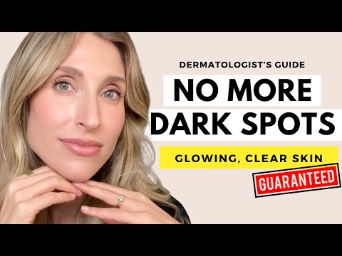 Видео: Темные пятна исчезли: моя идеальная программа для борьбы с гиперпигментацией и сияющей кожей | До...