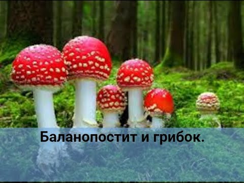 Видео: Молочница у мужчин. Баланопостит на фоне молочницы.