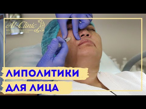 Видео: ЛИПОЛИТИКИ В ЛИЦО💉 || ХУДЕЕМ БЕЗ ДИЕТ || ПРОЩАЙ ВТОРОЙ ПОДБОРОДОК👋🏻  || Light Fit