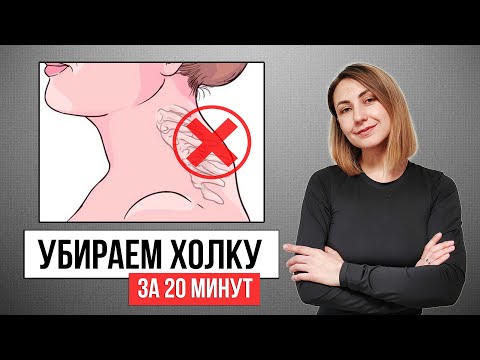 Видео: ХОЛКА уйдет навсегда! ВДОВИЙ ГОРБ - упражнения и МФР