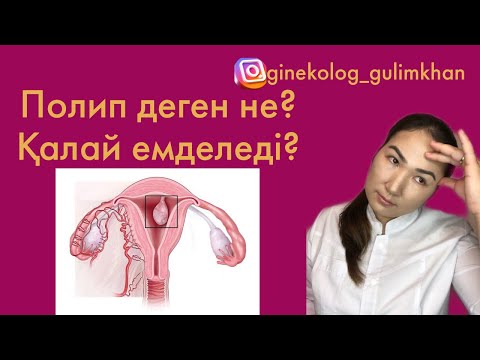 Видео: Полип неге пайда болады? Қалай емделеді?