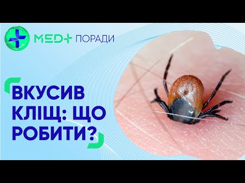 Видео: Укус кліща: що робити та які наслідки?