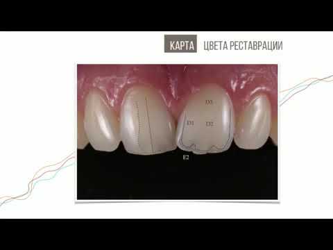 Видео: Вебинар Александра Кожемяка «Многогранный подход к эстетической реставрации фронтальных зубов»