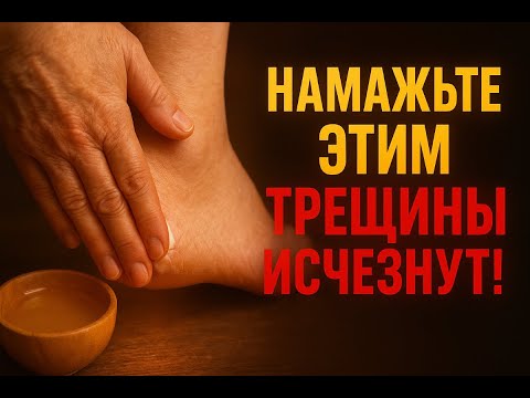 Видео: Намажьте этим — и трещины на пятках исчезнут!