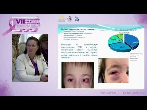 Видео: Саакян С.В., Склярова Н.В. | Рабдомиосаркома орбиты
