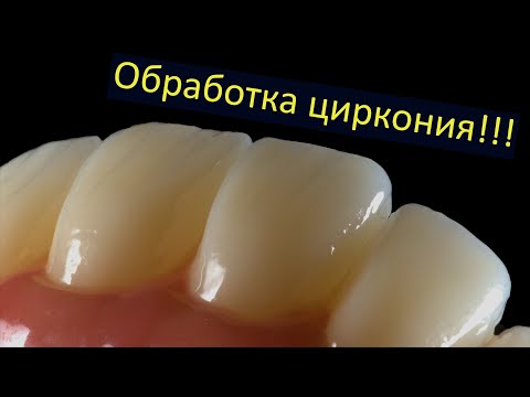 Видео: Обработка диоксида циркония. Коронки из циркона. Внутриротовое сканирование работает!