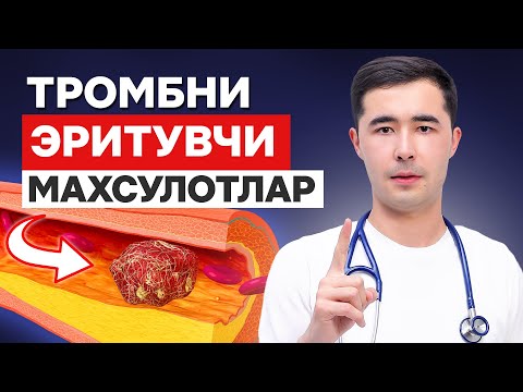 Видео: ТРОМБ ЭРИТУВЧИ ТОП 3 МАХСУЛОТ