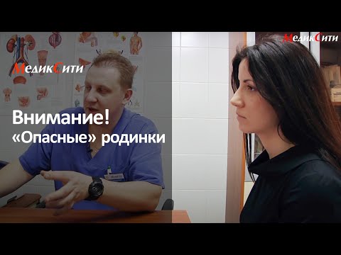 Видео: Внимание! "Опасные" родинки. Консультация дерматоонколога в "Медиксити"