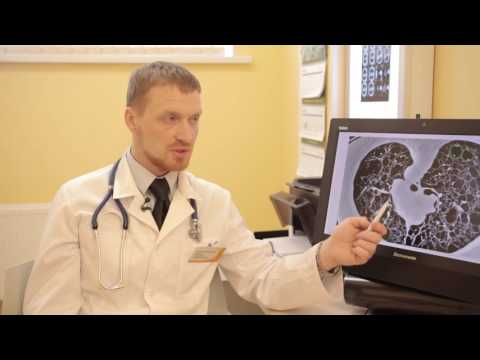 Видео: Буллёзная болезнь и пневмоторакс