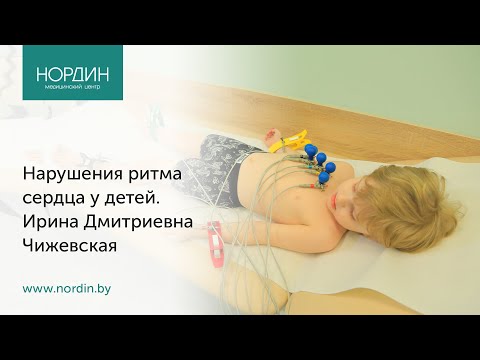 Видео: Нарушения ритма сердца у детей, врач Ирина Чижевская