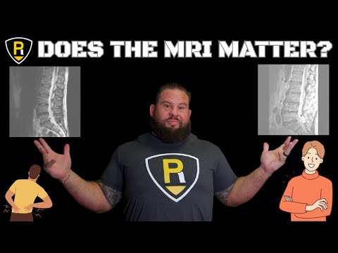 Видео: Действительно ли МРТ объясняет боль в спине?