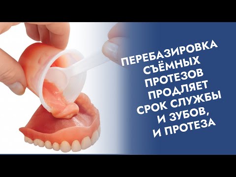 Видео: Съёмные протезы. Перебазировка=починка.