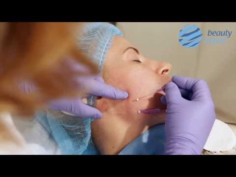 Видео: Мастер-класс по тредлифтингу мезонитями Lead Fine Lift Full Face от Елены Старковой Бьюти эксперт