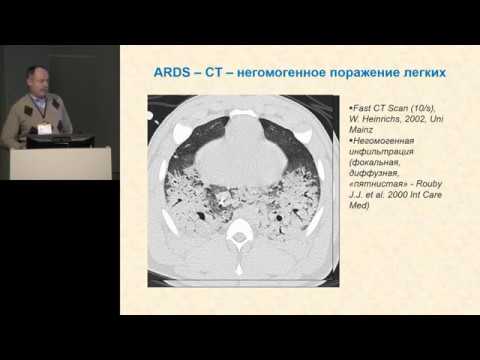 Видео: Стратегии рекрутмента легких во время ИВЛ Сатишур О Е 2019