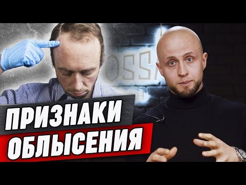 Видео: Если у вас есть эти признаки - ваша голова лысеет! / Как понять, что начинаешь лысеть?