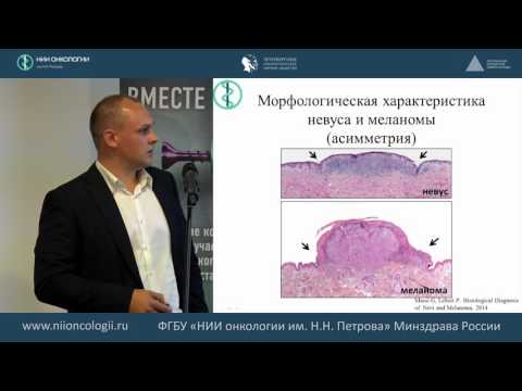 Видео: Принципы морфологического исследования меланомы кожи.