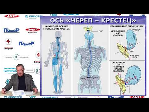Видео: Владимир Нечаев. Синдром короткой ноги. Визуальная и мануальная диагностика