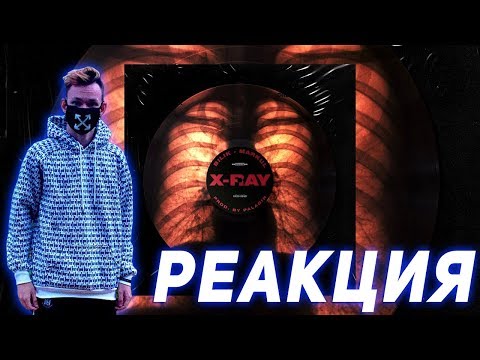 Видео: Реакция на БИЛИК & MARKUL — X-Ray