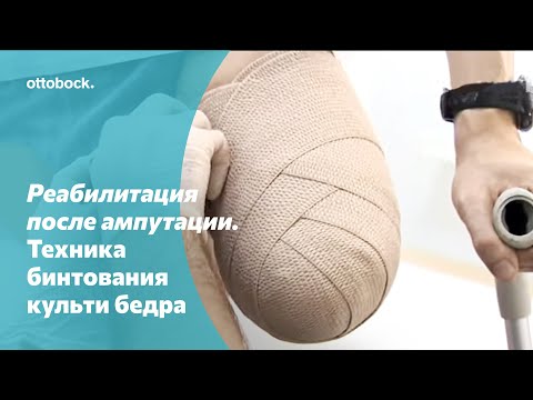 Видео: Реабилитация после ампутации. Техника бинтования культи бедра