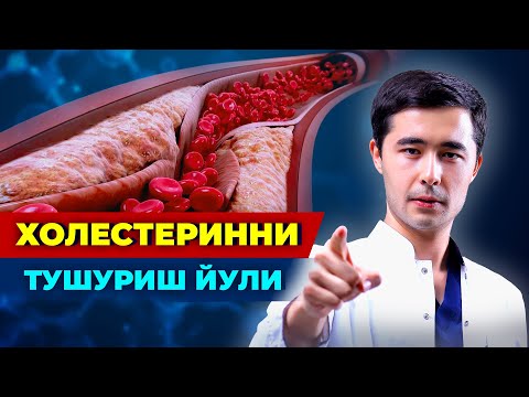 Видео: ХОЛЕСТЕРИН МИКДОРИНИ  ПАСАЙТИРИШ ЙУЛИ. БУНИ ХАММА БИЛИШИ ШАРТ