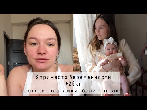 Видео: ТРЕТИЙ ТРИМЕСТР БЕРЕМЕННОСТИ | +26 кг | ОТЕКИ | БОЛИ В НОГАХ | СИМФИЗИТ ? | ПРЕДВЕСТНИКИ РОДОВ