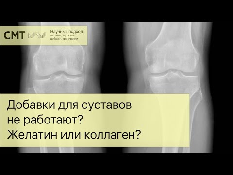 Видео: Добавки для суставов НЕ РАБОТАЮТ? Желатин или коллаген?