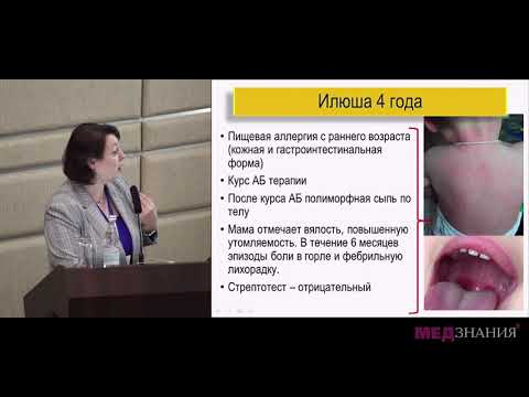 Видео: 4. У ребёнка острая или рецидивирующая Эпштейн-Барр вирусная инфекция. Как лечить?