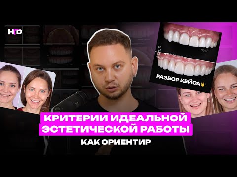 Видео: Критерии идеальной эстетической работы. Как ориентир | PROвиниры Прокопович Виктор