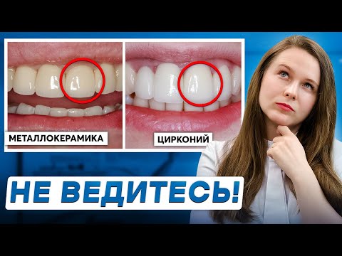 Видео: МЕТАЛЛОКЕРАМИКА или ЦИРКОНИЙ: Какие коронки лучше в 2024?