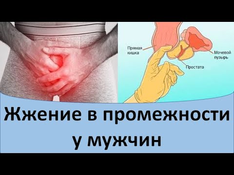 Видео: Жжение в промежности у мужчин