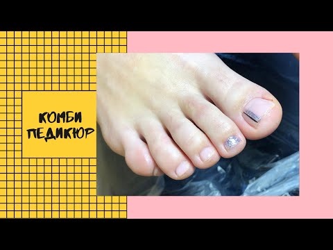 Видео: Комби педикюр + дизайн| Pedicure| Nail design