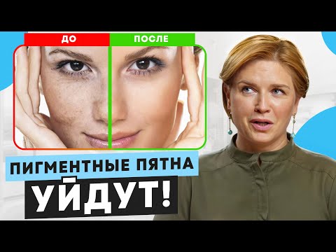 Видео: ЛУЧШИЕ способы убрать ПИГМЕНТНЫЕ ПЯТНА! Кожа будет на 10 лет моложе!