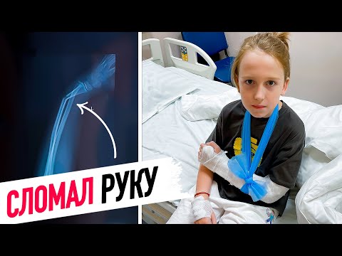 Видео: VLOG: Илья СЛОМАЛ РУКУ. Как это произошло?