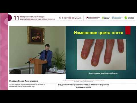 Видео: Поражения ногтей в онкологии и дерматологии