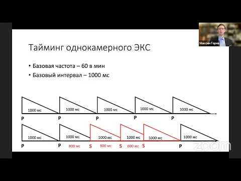 Видео: Пациент после имплантированного ЭКС/СРТ