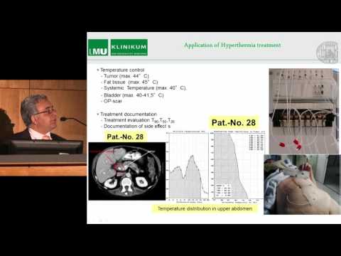 Видео: Гипертермия в онкологии - опыт применения у больных с раком поджелудочной железы