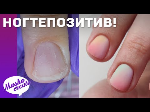 Видео: Это синяк или грибок?.. НОГТЕПОЗИТИВ! Модный маникюр 2020 на широких ногтях ТРАПЕЦИЯ.
