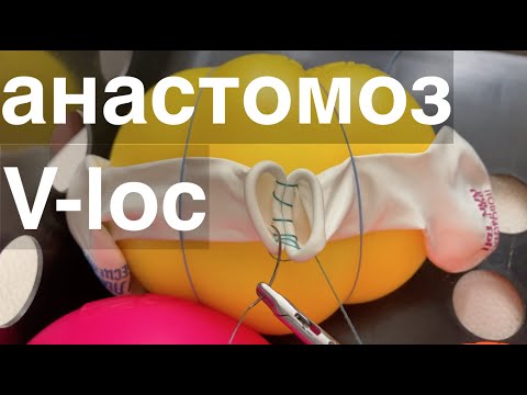 Видео: анастомоз v-loc // шаг 3  // anastomosis step 3