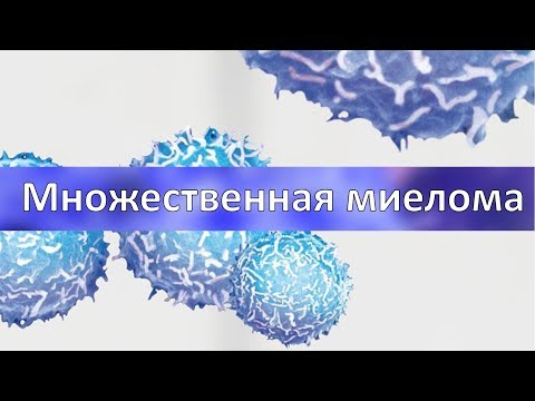 Видео: Множественная миелома