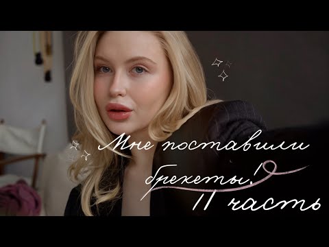 Видео: МНЕ ПОСТАВИЛИ БРЕКЕТЫ! МОЯ ИСТОРИЯ / КАК ЖИТЬ С БРЕКЕТАМИ? 1 ЧАСТЬ