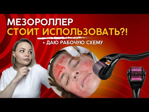 Видео: Мезороллер. Посмотри, прежде чем его использовать!