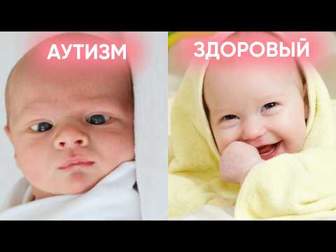 Видео: Ранние ПРИЗНАКИ АУТИЗМА! Как не пропустить тревожные симптомы у ребёнка?